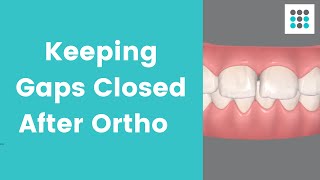 KEEPING YOUR GAPS CLOSED AFTER ORTHO l Dr Bailey Orthodontist [upl. by Englebert]