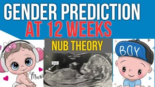 Early Gender Prediction in scan using NUB theory 12 weeks Pregnancy [upl. by Aseeral]