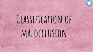 Angles Classification of Malocclusion  Easily Explained [upl. by Ennyroc]