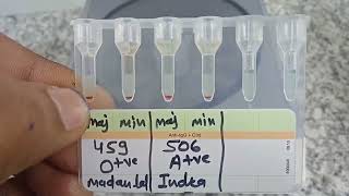 medicallabtechnologist6489 Blood Crossmatch Gel card method AgAbReaction MLT lab Blood [upl. by Nospmoht]