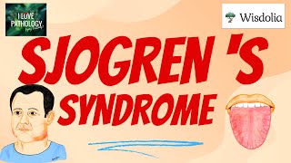 SJOGRENS SYNDROME  Etiopathogenesis Morphology Clinical Features amp treatment [upl. by Choo]