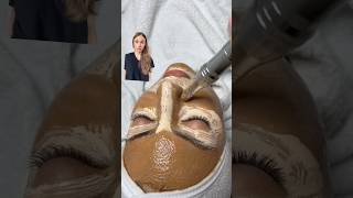 Watch Out BB Glow Facial Could Be Your Beauty Nightmare [upl. by Loredana]