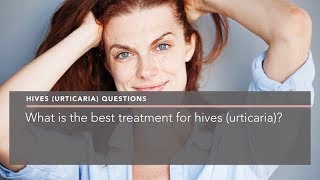 What is the best treatment for hives urticaria [upl. by Oynotna]