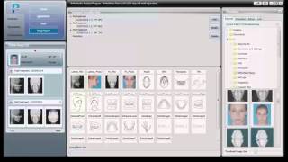 01 Basic Introductory Instructional Tutorial Video For OrthoVision [upl. by Magree]