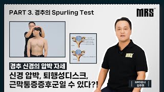 Part 3 경추의 Spurling test • MRS 재활트레이너를 위한 【ONE STOP EDUCATION】 [upl. by Johnath]