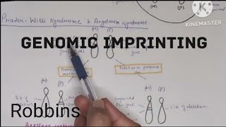 Genomic imprinting PraderWilli and Angelman syndrome Robbins हिंदी [upl. by Blum649]