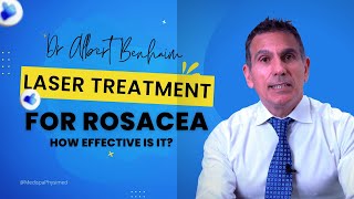 Laser Treatment For Rosacea How Effective Is It [upl. by Burgwell61]