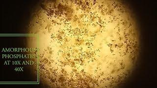 Amorphous phosphates crystals under microscope at 10X and 40X [upl. by Narcho901]