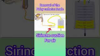 Foley catheter कैसे remove करेFoley catheterurin bag कैसे निकाले facts medifact shortsfeed [upl. by Attekram]