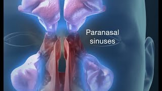 Endoscopic Sinus Surgery for Pain Drainage Infections and Impaired breathing [upl. by Casandra]