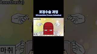 포경수술 과정The Circumcision Process Animation animation 병맛애니 [upl. by Odrareg619]