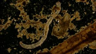 🔬 Aeolosomatidae cariegatum under a dark field microscope  life in a drop of water 4K [upl. by Etteinotna]