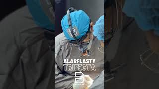 Alarplasty Trifecta Achieve the refinement you want with a more subtle approach [upl. by Idnod135]