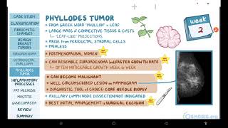 Benign breast conditions  pathology review  Osmosis [upl. by Gothard]