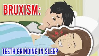 Bruxism Teeth grinding in sleep [upl. by Oidacra]