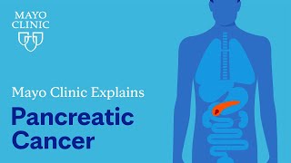 Mayo Clinic Explains Pancreatic Cancer [upl. by Wendeline283]