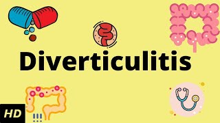 Diverticulitis Causes SIgns and Symptoms Diagnosis and Treatment [upl. by Atiruam818]