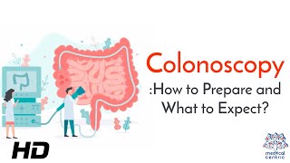 Colonoscopy The Lifesaving Procedure You Shouldnt Ignore [upl. by Aratal]