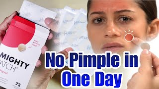 Mighty Patch  Remove you r pimples in A Day [upl. by Enahs]