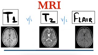 T1 MRI vs T2 MRI vs FLAIR MRI  MRI Brain  Radiology [upl. by Llevaj]