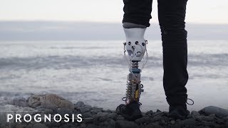 This MIT Engineer Built His Own Bionic Leg [upl. by Rockwell961]