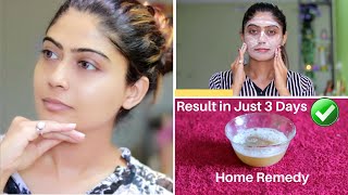 OMG 😮 This Facial Remove Your Dark Spots Brown Spots Pigmentation amp Pimples in just 3 Days [upl. by Portland]