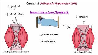 Orthostatic Hypotension Described Concisely [upl. by Airehtfele]