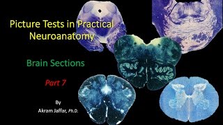 Picture Test in Neuroanatomy Brain Sections 7 [upl. by Dinesh766]