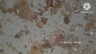 Dust mites with headcrab sounds [upl. by Neerual]