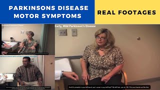 Parkinsons Disease Motor Symptoms  Real Fooatages [upl. by Muhammad]