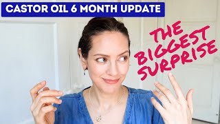 Castor oil benefits for skin and My big surprise [upl. by Sucul]