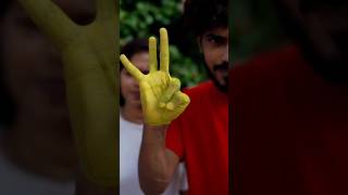 Extreme Finger twistingtrick shortvideo [upl. by Bopp]