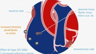 Ação dos antiarrítmicos classe III  wwwarritmiaonlinecombr [upl. by Heger]