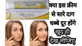 Kojivit Ultra Gel Review  Acne scars or dark spot को remove kre [upl. by Nolat]