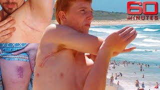 Melanoma victims share heartbreaking warning  60 Minutes Australia [upl. by Tletski]