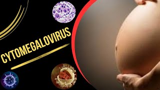 Cytomegalovirus Infection in Pregnancy  Congenital Cytomegalovirus Infection  Cytomegalovirus [upl. by Olegnaid168]