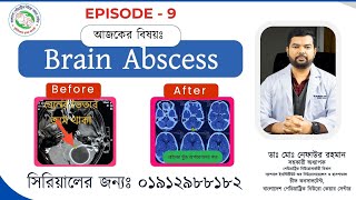 Before After Episode 09 Brain Abscess Surgery By Best Paediatric Neurosurgeon Nafaur in Bangladesh [upl. by Nikolas]