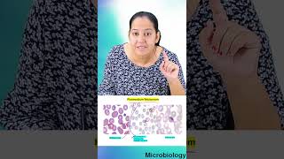 1 minute learning Plasmodium falciparum morphology [upl. by Hujsak]