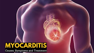 Myocarditis Causes Signs and Symptoms Diagnosis Treatment [upl. by Bevvy]