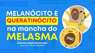 MELANÓCITO E QUERATINÓCITO NA MANCHA DE MELASMA  Cosmetologia Explicada com Prof Marcio Guidoni [upl. by Ailehpo]