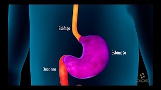 Endoscopia Digestiva Alta [upl. by Dela]