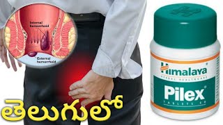 Piles and fissure treatment in allopathic harsh molalu modern medicine in Telugu [upl. by Bolan]