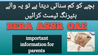 Hearing test for kids  BERA test  ASSR test  BERA test kaise hote hai [upl. by Naillimixam744]