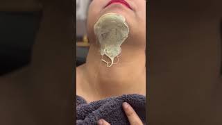 chinwax how to remove chin hair [upl. by Florio]