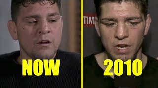 Does Nick Diaz Have CTE Speech Analysis [upl. by Adnorrehs974]