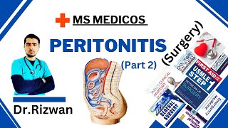 Peritonitis Part 2SurgeryMS MedicosDr RizwanUrdu Hindi Easy Explanations [upl. by Berlinda]