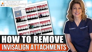 How To Properly Remove Invisalign Attachments [upl. by Zebada]