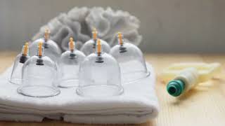 The Wisdom of Hijama A Sunnah for Modern Health [upl. by Kata]