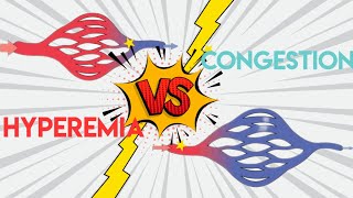 Mnemonics Hyperemia Vs Congestion Pathology  Acute Inflammation [upl. by Natalya238]