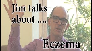 Jim talks about  Eczema [upl. by Nitnert]